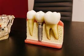 When choosing a private dentist, consider the following factors